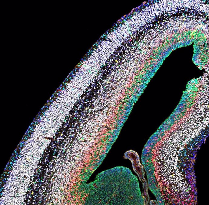 Suiza/Bélgica/Austria.- Investigadores identifican cómo se genera un cerebro de tamaño y composición correctos