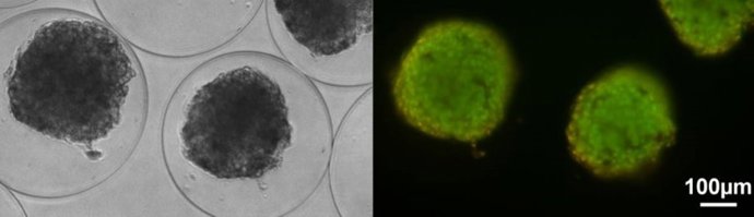 UPV/EHU tratamiento de la diabetes mellitus tipo 1