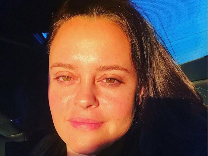 Shaila Durcal se muestra natural al mostrar las secuelas de su fatal accidente