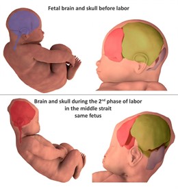 Los cerebros y los cráneos de los bebés cambian de forma momentos antes del parto natural