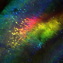 Neuronas en el área CA2 del cerebro