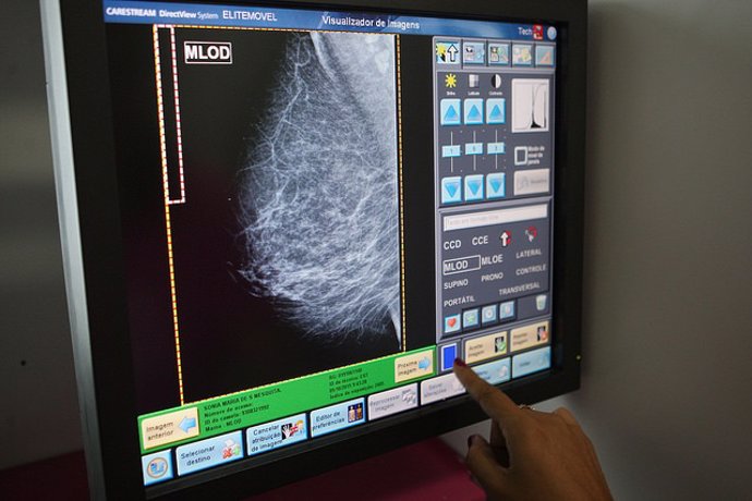 Más de 7.600 extremeñas se someterán a mamografías en mayo dentro del Programa de Detección Precoz del Cáncer de Mama