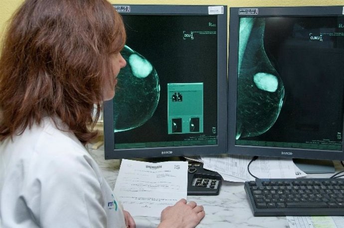 Extremadura.- Más de 7.600 extremeñas se someterán a mamografías por el Programa de Detección Precoz del Cáncer de mama