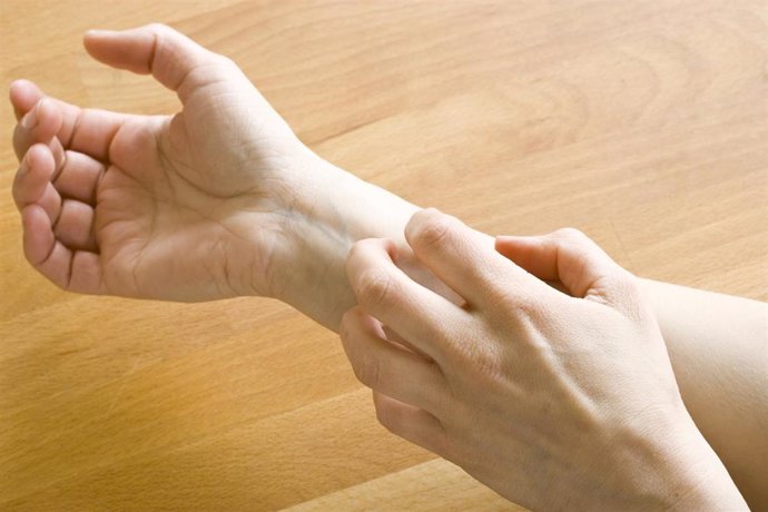 Al 58% de personas con dermatitis atópica grave les avergüenza su piel