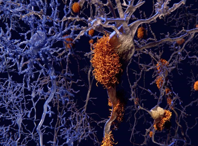 Investigadores demuestran el potencial de la inmunoterapia anti-tau en el tratamiento del Alzheimer