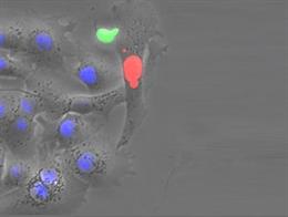 Investigadores logran por primera vez eliminar el virus de la hepatitis B en un modelo de ratón