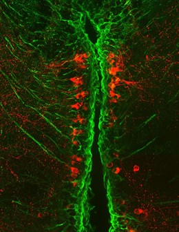 Pistas sobre el Parkinson observadas en peces pequeños podrían ayudar en la búsqueda de tratamientos