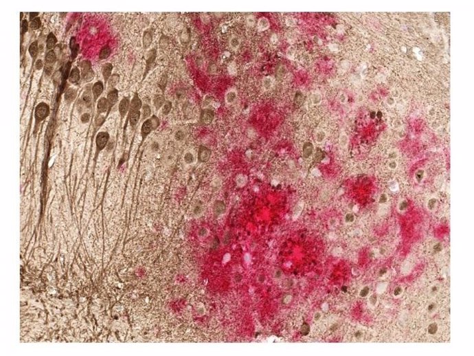 Cerebro de un ratón modelado para tener la enfermedad de Alzheimer
