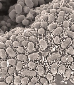 Micrografía electrónica de barrido del intestino del ratón infectado con 'Staphylococcus aureus'