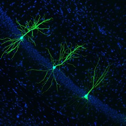 La inhibición de una enzima llamada LIMK1 parece mejorar la longitud y la densidad de las espinas dendríticas, que se muestran aquí en verde. Se cree que las espinas dendríticas saludables tienen un efecto protector contra la enfermedad de Alzheimer.