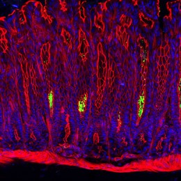 Sección transversal a través de la mucosa gástrica de un ratón: La bacteria 'Helicobacter pylori' (verde) coloniza las cavidades de las glándulas gástricas. Los núcleos de las células de la membrana mucosa están representados en azul, su citoesqueleto e