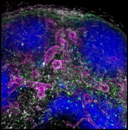 Los anticuerpos administrados por vía subcutánea se han transportado al ganglio linfático y se han unido a sus dianas específicas en los vasos sanguíneos (magenta), linfocitos T (verde), linfocitos B (azul) y células presentadoras de antígeno (blanco).