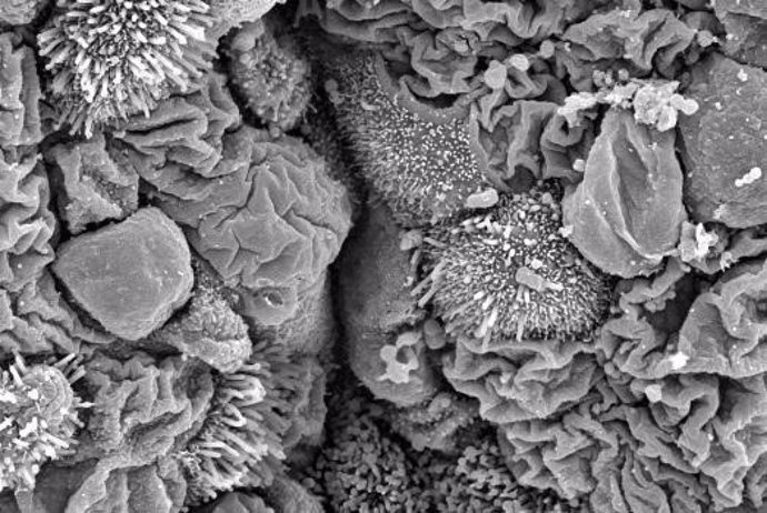 Micrografía electrónica de barrido de células epiteliales que recubren el interior del pulmón. Los diferentes tipos de células con diferentes formas y diferentes funciones componen este revestimiento interno, y el equilibrio correcto entre estos tipos d