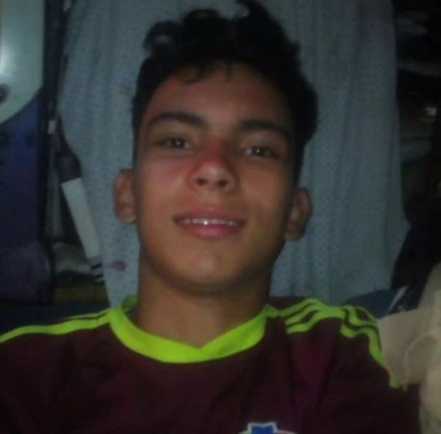 Rufo Antonio Chacó, el menor que ha perdido la vista en una protesta en Venezuela