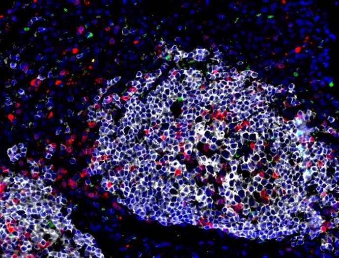 EE.UU.- Reforzar una célula inmunológica recién descubierta, crucial para combatir la tuberculosis desde su inicio
