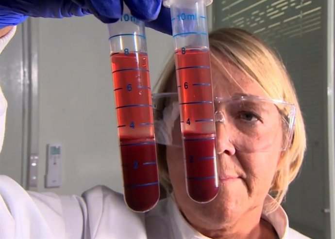 Investigadores de la Escuela de Biociencias de la Universidad de Nottingham preparan muestras de sangre para las pruebas 'Actiphage'