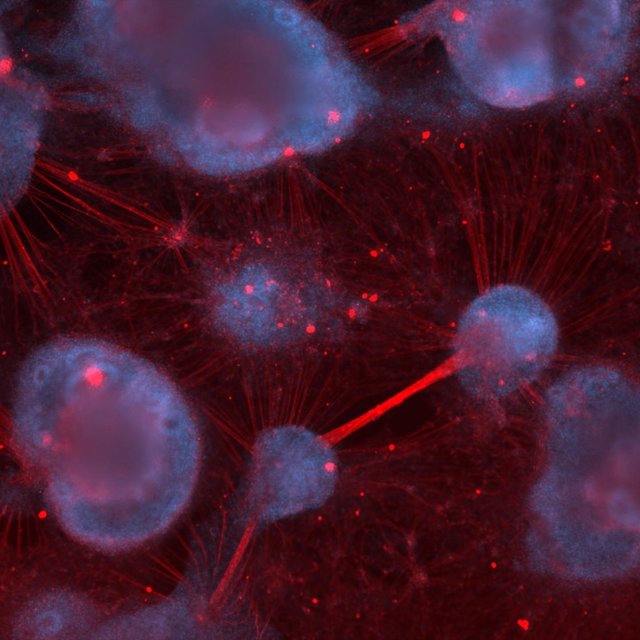 La imagen muestra neuronas sensoriales humanas derivadas de células madre cultivadas en el laboratorio.