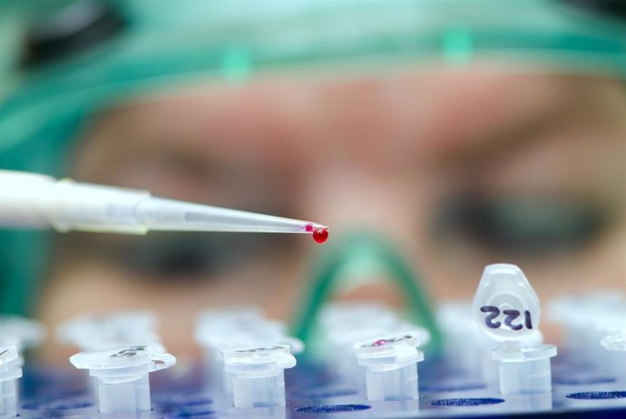 Asistente de laboratorio analiza una infección peligrosa. VIH, sida, investigación 