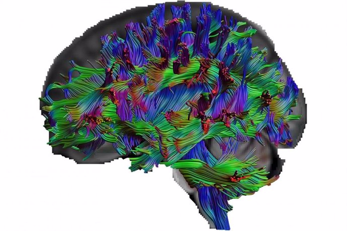 Con imagen del tensor de difusión, los investigadores pueden visualizar las vías de las fibras nerviosas del cerebro