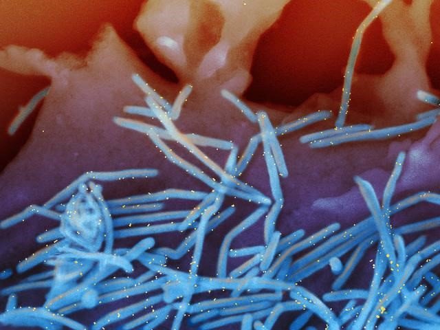 Micrografía electrónica de barrido coloreada de viriones del virus respiratorio sincitial respiratorio (azul) .