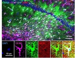 Una imagen representativa de la sobreexpresión de receptores opioides mu en astrocitos hipocámpicos de ratones.