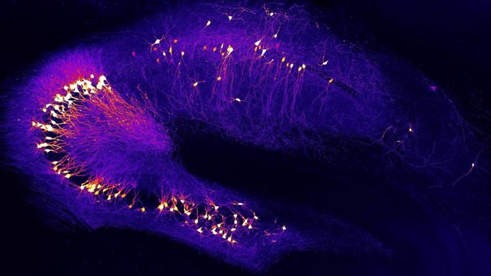 Neuronas en el hipocampo, una región del cerebro clave para el aprendizaje y la memoria, que ya está dañada en las primeras etapas de la enfermedad de Alzheimer.