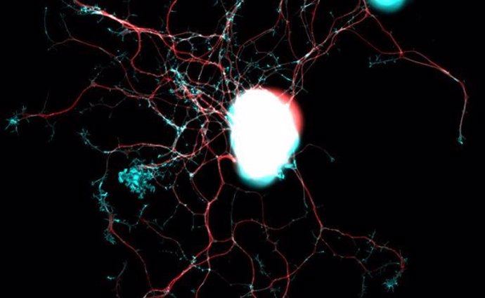 Neurona de los ganglios de la raíz dorsal bajo el microscopio