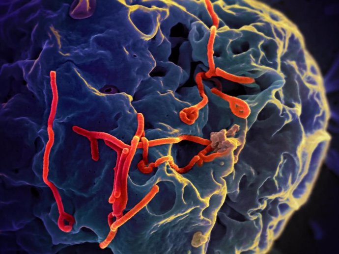 Imagen microscópica del virus del ébola.