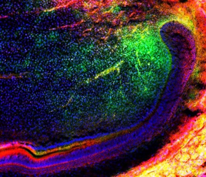 La imagen muestra un grupo de células madre mesenquimales (verdes) migrando en un diente para regenerar aún más los tejidos.