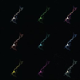 Collage de células neuronales utilizadas en este estudio. Las neuronas aquí expresan una proteína que fluoresce al unirse a la bilirrubina.