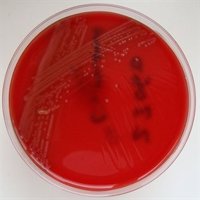 La carne con listeria se distribuyó también en Madrid y Extremadura pero ha sido retirada y no hay casos, según Sanidad