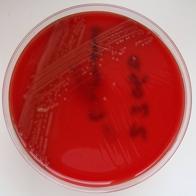 Listeria  monocytogenes.