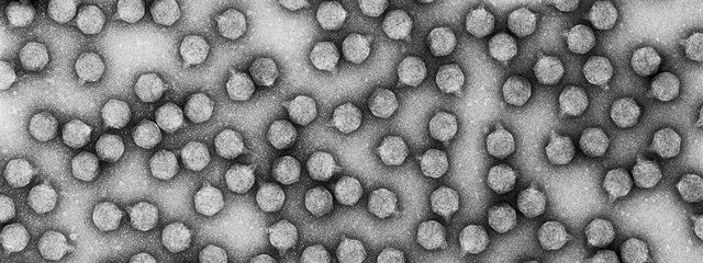 Imagen del virus bacteriófago T7