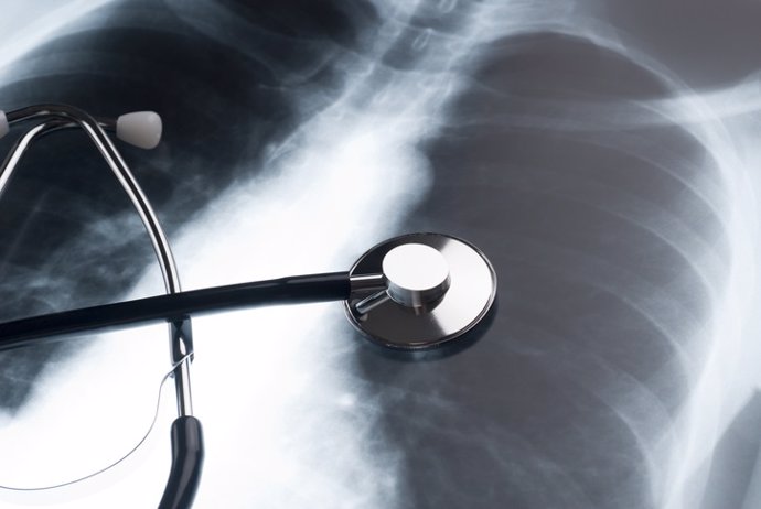Los niveles de succinato en los pulmones de pacientes con fibrosis quística favo