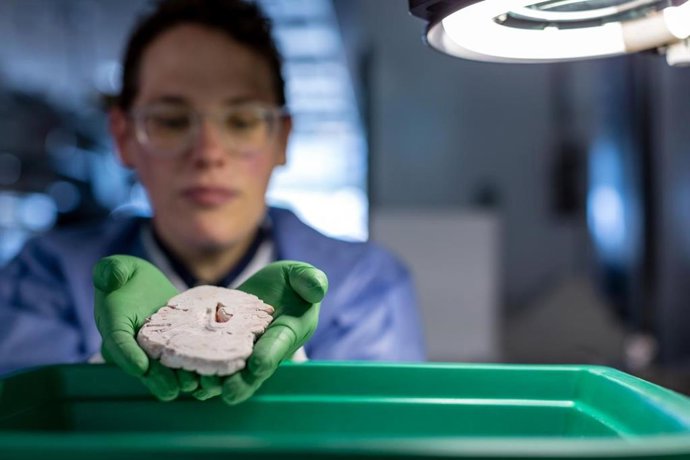 La científica del Instituto Allen Rebecca Hodge examina una porción de cerebro humano. Esta es una de varias muestras de cerebro utilizadas en un estudio de comparación de tipos de células cerebrales humanas y de ratón.