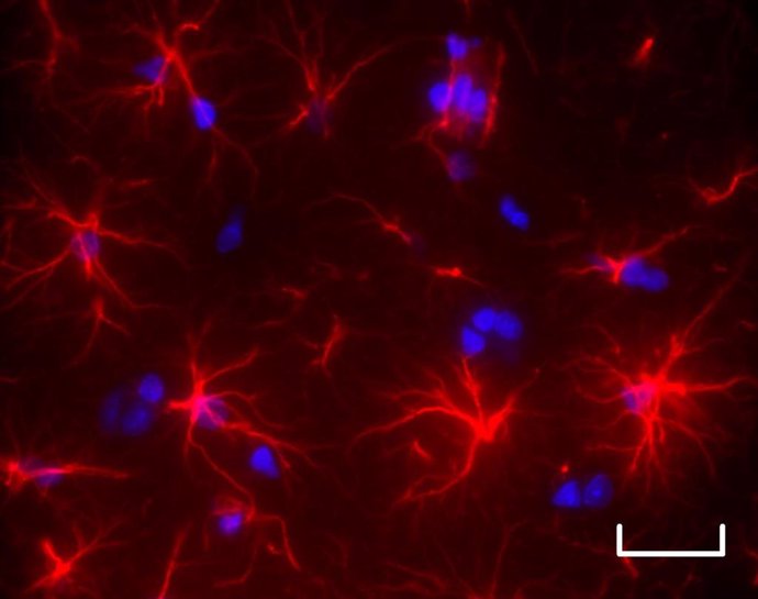 Cuatro semanas después de la aparición de la enfermedad hepática, las células astrocíticas (rojas) en los cerebros de las ratas enfermas muestran una morfología alterada con acortamiento y reducción en el número de sus extensiones