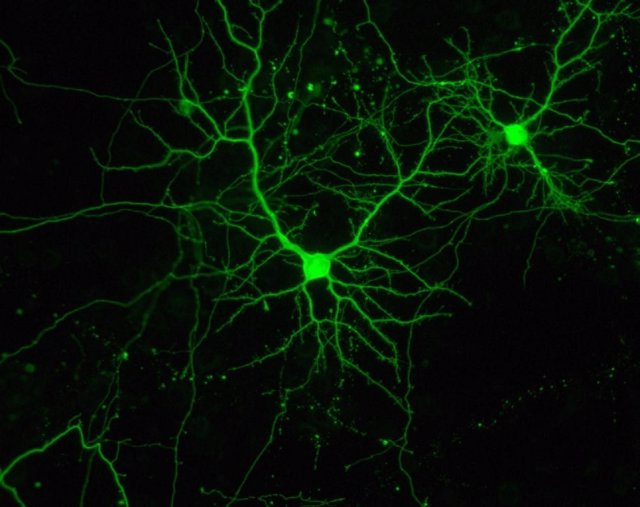 Dos neuronas, en cultivo.
