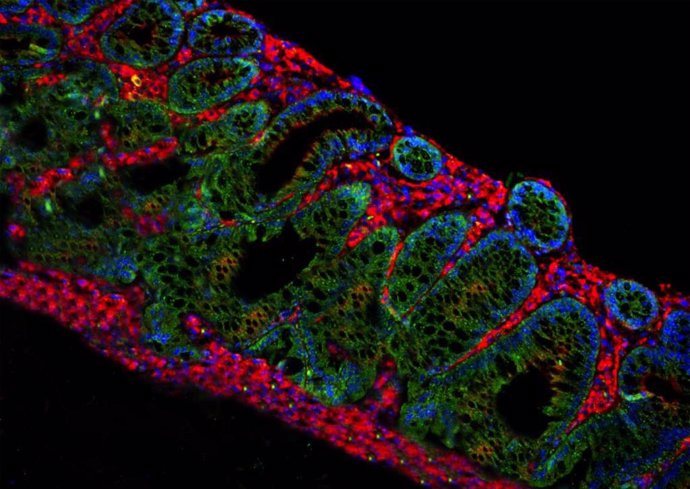 Identifican un mecanismo que promueve la progresión de inflamación crónica hacia