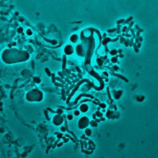 Una bacteria 'E.Coli' qeue ha cambiado a una forma en L, es decir, sin pared celular, para evitar a los antibióticos