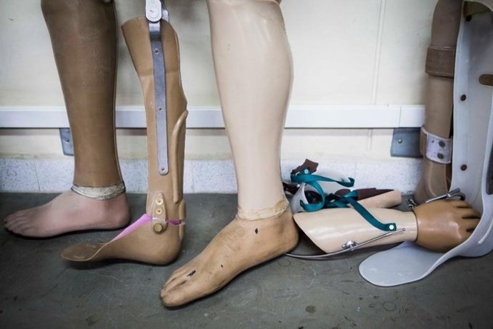 Prótesis para personas víctimas de minas antipersona en Colombia