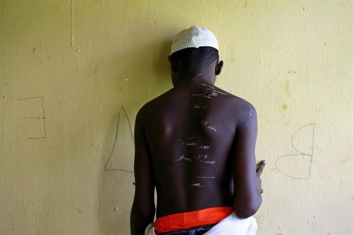 Un adolescente de 15 años, uno de los cerca de 400 rescatados de una escuela coránica en Nigeria en la que eran sometidos a palizas y abusos