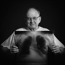 Imagen de archivo de la exposición fotográfica 'El rostro de la tuberculosis', en la que se muestra a través de la vía artística las consecuencias de la tuberculosis en la salud y la vida de las personas