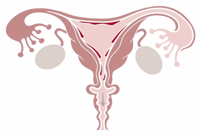 Digital illustration of shedding uterine lining during menstruation