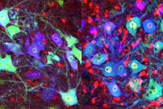 La médula espinal postnatal del ratón con la proteína cofilina en rojo a la izquierda. A la derecha, la cofilina (rojo) ha sido desactivada por el gen Limk1. Las neuronas se muestran en verde y las neuronas motoras en azul.