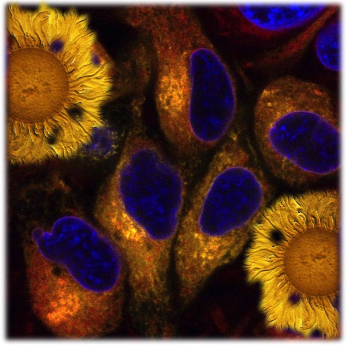 Células humanas mostrando la localización de la proteína TMEM189 en el retículo endoplásmico, adornadas con colonias amarillas de la bacteria Myxococcus xanthus (esquina superior izquierda e inferior derecha).