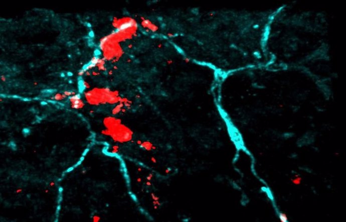 Los mastocitos y las neuronas sensoriales se agrupan en "racimos" bajo la piel
