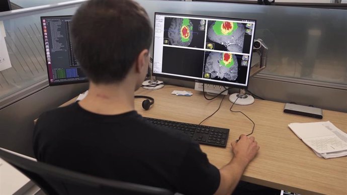 Investigadores del King's College de Londres usan la tecnología de Nvidia para identificar tumores cerebrales.