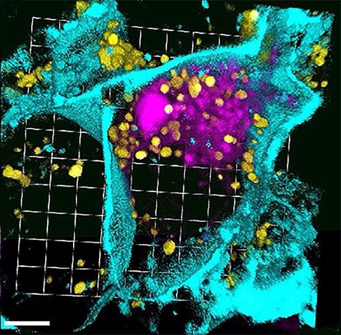 Reconstrucción en 3D de una sola célula de cáncer de páncreas tratada con nanopartículas de siARN