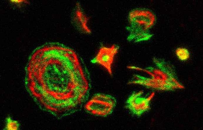    Un estudio del Grupo de División Celular y Cáncer del Centro Nacional de Investigaciones Oncológicas (CNIO) ha permitido entender a través de MASTL, una proteína cuyo papel en el organismo es aún poco conocido, el origen molecular de la trombocitopen