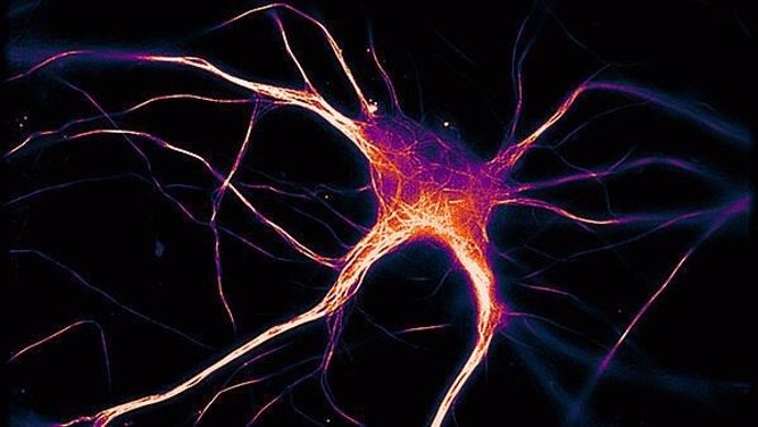 Una célula cerebral funcional que expresa tau enferma propia del Alzheimer.